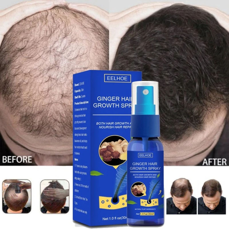 Epidermal Growth Factor - Sérum de croissance des cheveux au
