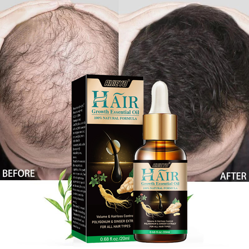Epidermal Growth Factor - Huile de croissance rapide des cheveux