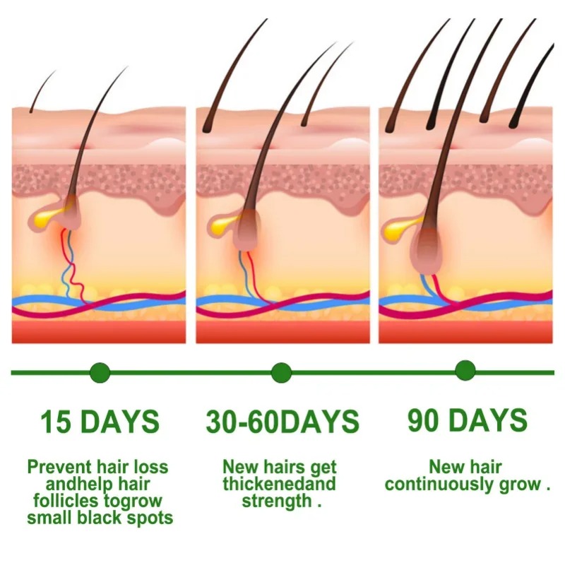 Sérum de croissance des cheveu - Epidermal Growth Factor avis et prix