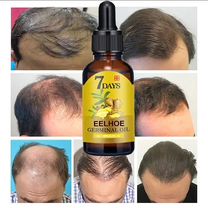 Huile de Croissance Rapide des - Epidermal Growth Factor avis et prix