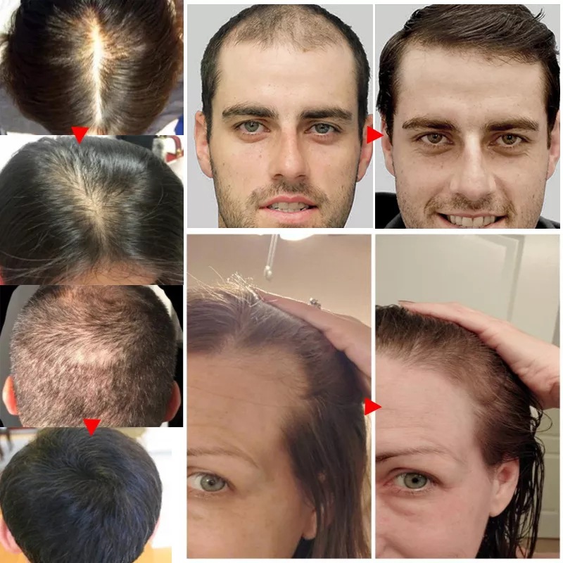 Huile de croissance rapide des - Epidermal Growth Factor avis et prix