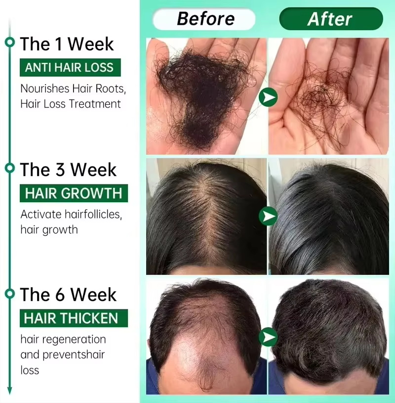 Sérum de croissance des cheveu - Epidermal Growth Factor avis et prix